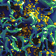 An electron micrograph of HIV particles infecting a human T cell. Image: National Institute of Allergy and Infectious Diseases